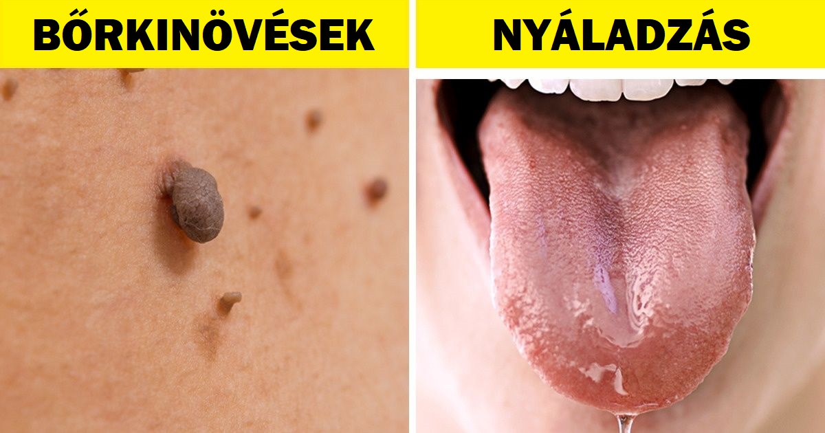 A terhesség 8 váratlan jele, amiről talán nem is tudsz