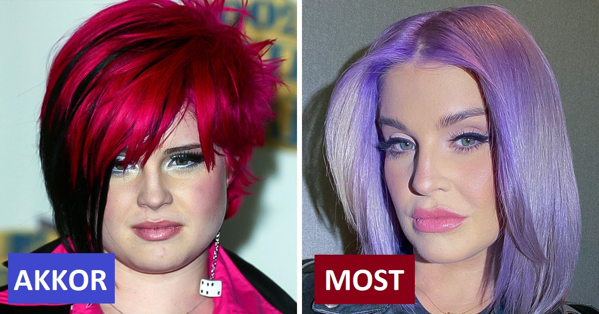 Kelly Osbourne nem tudta, hogy valaha is anya lesz-e, de most első közös gyermekét várja Sidney Wilsonnal