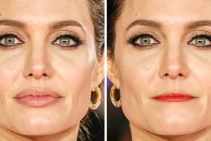 17 fotó, amelyek megmutatják, hogyan változtathatja meg az arcodat az ajkad átalakítása
