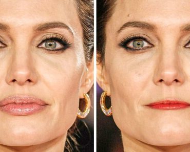17 fotó, amelyek megmutatják, hogyan változtathatja meg az arcodat az ajkad átalakítása