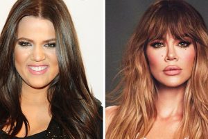 Khloé Kardashian felfedte az igazi titkokat az átalakulása mögött és eloszlatta a pletykákat