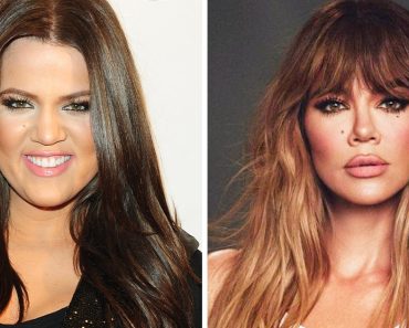 Khloé Kardashian felfedte az igazi titkokat az átalakulása mögött és eloszlatta a pletykákat