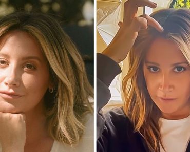 „A húszas éveim elején észrevettem egy kopasz foltot” Ashley Tisdale úgy döntött, hogy megnyílik arról, hogy alopeciában szenved, hogy segítsen megszüntetni a megbélyegzést