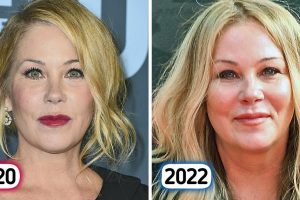 Christina Applegate szembeszállt egy trollal, aki szerint az arcát a plasztikai műtét tette tönkre, nem a szklerózis multiplex