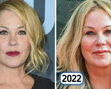 Christina Applegate szembeszállt egy trollal, aki szerint az arcát a plasztikai műtét tette tönkre, nem a szklerózis multiplex