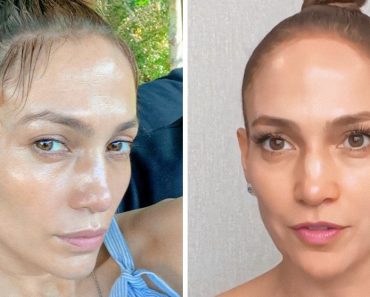 A bőrgyógyász felfedett 4 valódi okot, amiért az 53 éves Jennifer Lopez nem öregszik, és ez több, mint plasztikai műtét vagy termékek