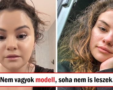 Selena Gomez elárulja, miért hízik, és üzenetet küld a testszégyenítőknek