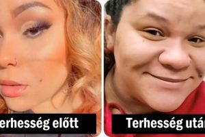 „2 különböző ember”: A 24 éves nőnek extrém „terhességi orra” van, és az emberek nem ismerik fel az arcát
