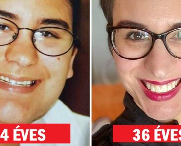20 ember, akik hatalmas átalakuláson mentek keresztül a korral