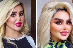 43 kozmetikai beavatkozáson estem át, hogy úgy nézzek ki, mint egy Barbie, de a kritikusok szerint úgy nézek ki, mint egy „zombi”