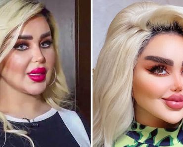 43 kozmetikai beavatkozáson estem át, hogy úgy nézzek ki, mint egy Barbie, de a kritikusok szerint úgy nézek ki, mint egy „zombi”
