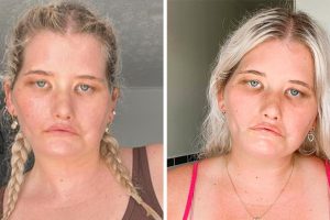 Egy lány, aki „nem tud mosolyogni”, modell lesz, és bebizonyítja, hogy a szépség sokféleképpen megmutatkozik