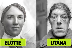 Egy anya tragikus története, aki a „legcsúnyább nő” lett, hogy megmentse gyermekeit.