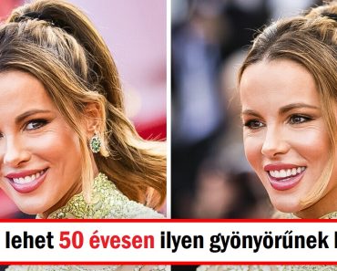 Kate Beckinsale őszintén válaszol azoknak, akik ragaszkodnak hozzá, hogy arcplasztikája volt Kate Beckinsale őszintén válaszol azoknak, akik ragaszkodnak hozzá, hogy arcplasztikája volt