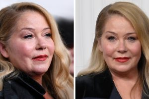 „Félek zuhanyozni” Christina Applegate szívszorító híreket ad intim küzdelmeiről a szklerózis multiplex miatt