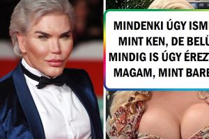 Egy „emberi Ken baba” 1 MILLIÓ dollárt költött plasztikai műtétekre, hogy úgy nézzen ki, mint egy Barbie