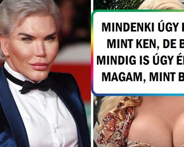 Egy „emberi Ken baba” 1 MILLIÓ dollárt költött plasztikai műtétekre, hogy úgy nézzen ki, mint egy Barbie