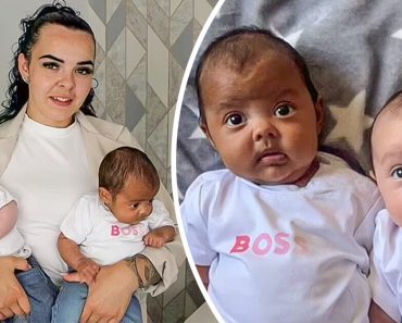 Egy fehér anya és félig jamaicai partnere különböző bőrszínű ikreket köszöntenek Egy fehér anya és félig jamaicai partnere különböző bőrszínű ikreket köszöntenek