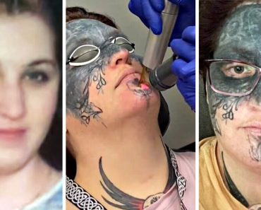 Egy nő, akinek az arcát tetoválták, „életváltozást” tapasztal, miután egy idegen felajánlotta, hogy segít az eltávolításban