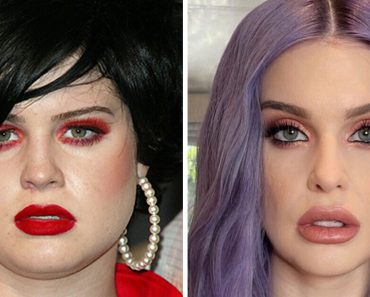 Kelly Osbourne kitart amellett, hogy nem volt semmilyen szépészeti műtéte, és ezt így magyarázza meg Kelly Osbourne kitart amellett, hogy nem volt semmilyen szépészeti műtéte, és ezt így magyarázza meg