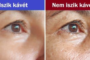 Mi történhet a bőröddel, ha teljesen leszoksz a kávéról