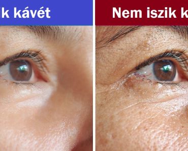 Mi történhet a bőröddel, ha teljesen leszoksz a kávéról