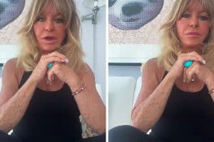 Goldie Hawn bőre miatt aggódnak az internetezők