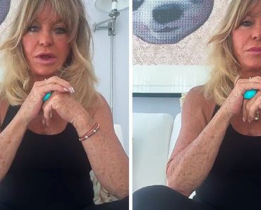 Goldie Hawn bőre miatt aggódnak az internetezők