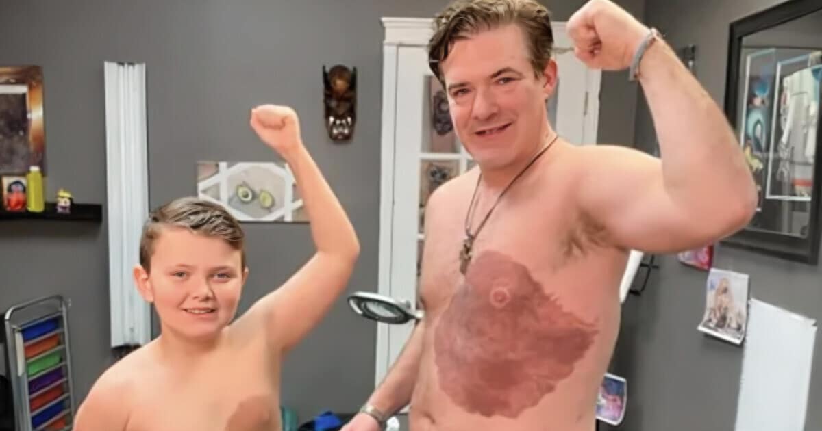 Egy apa 30 órányi tetoválási fájdalmat élt át, hogy a fia jobban érezze magát az anyajegyével kapcsolatban (Fotók)