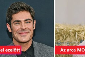 Zac Efron néhány nappal ezelőtti megjelenése sokkolta és aggasztotta a rajongókat