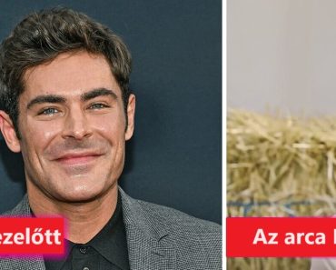 Zac Efron néhány nappal ezelőtti megjelenése sokkolta és aggasztotta a rajongókat
