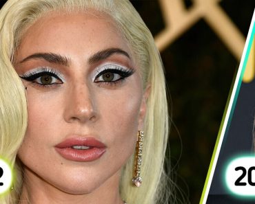 „Hagyja békén az arcát” –  Lady Gaga legújabb megjelenése vitát vált ki