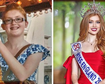 Egy hölgyet a külseje miatt zaklattak, most ő lett az első vörös hajú, akit megkoronáztak Miss Angliának